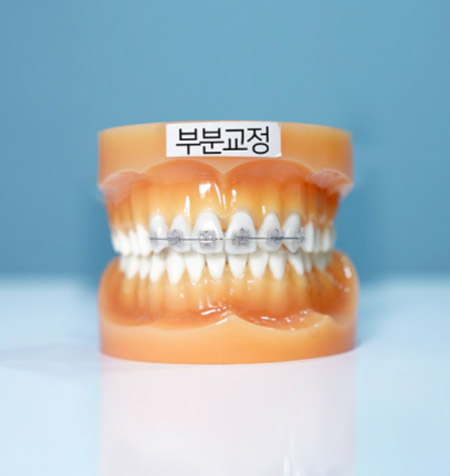 서울더블유치과